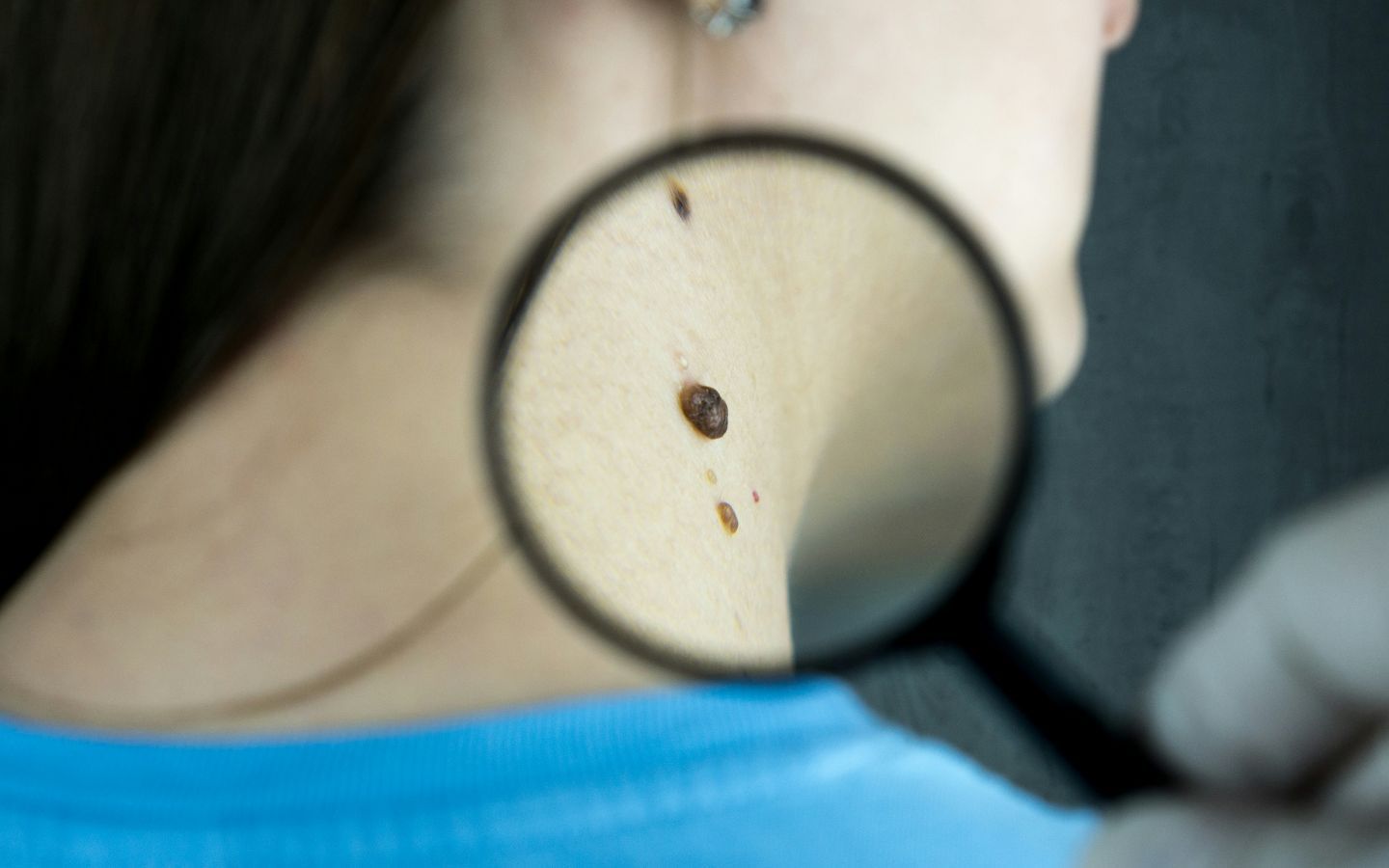 ¿Qué es la IARC, y Cómo Protege tu Salud?